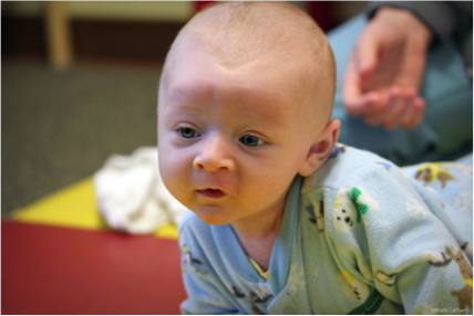 La torticoli, una molesta contracció muscular que implica repòs