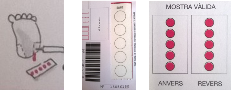 Imágenes prueba del talón